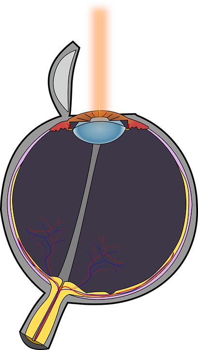 Why You Should Consider Laser Eye Treatment In Sydney Figure 8